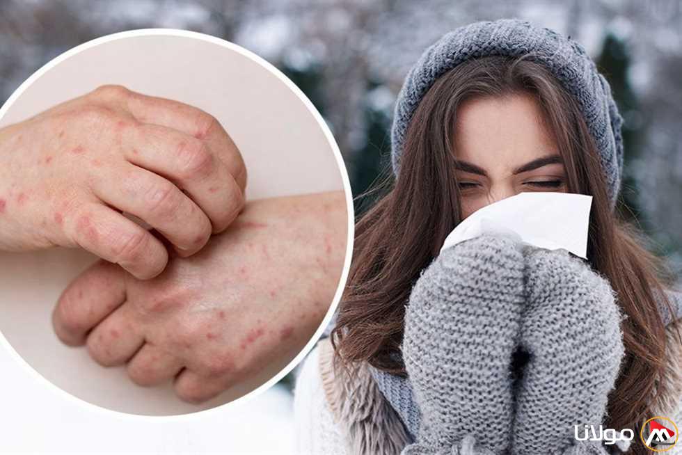 كيف تحمي نفسك من نزلات البرد خلال تغيرات الفصول والطقس؟ إليك 7 نصائح فعالة